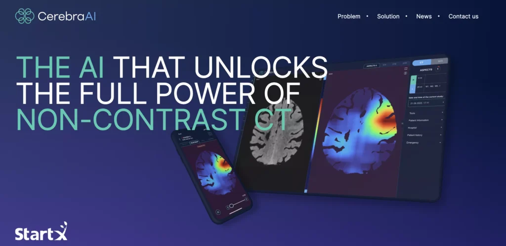 Cerebral AI NeuroEdge-S